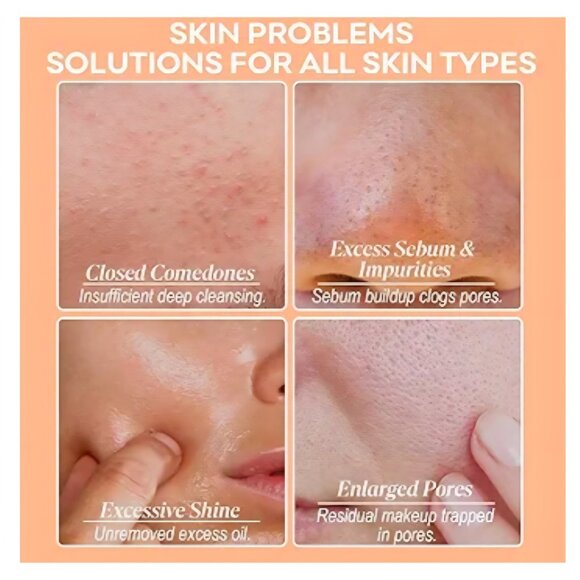 Deep Pore Clay Mask, Blackhead Remover Mask w/ Amazonian White Clay 7oz (200g) - Picture 5 of 10